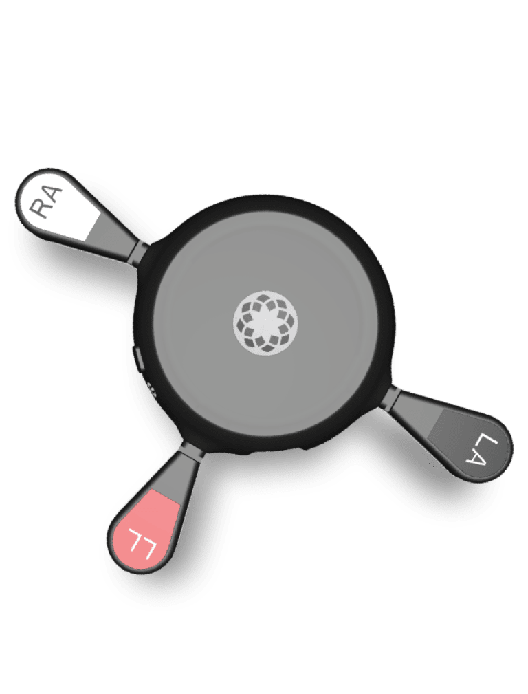 Biocore Heart Monitor for Patients | ECG/EKG Monitor - Biotricity